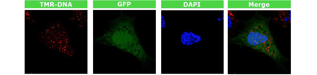 4D-nucleofectorD(zhun)xD(zhun)ȾGFP|(zh)ٱ_(d)